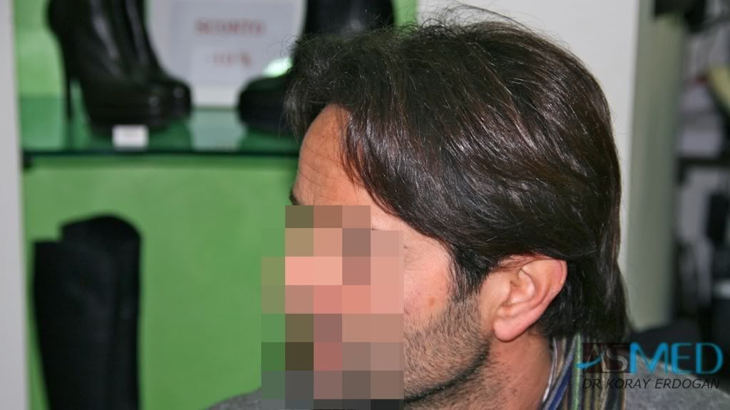 Shampoo di erba il 3o restauro per i capelli secchi e danneggiati di cioccolato